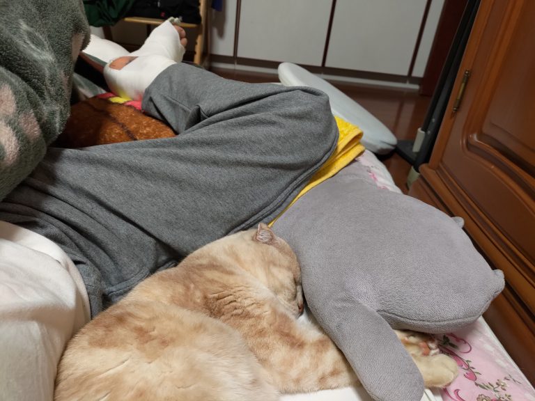 足の骨折では挙上がとても重要